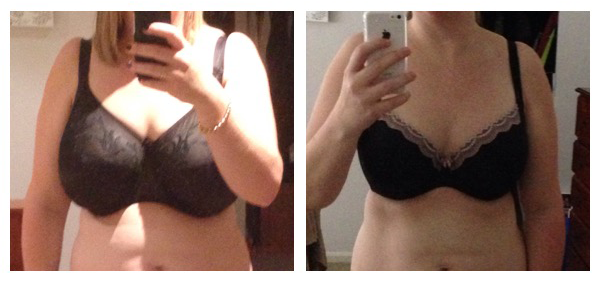 My journey to breast reduction— 30JJ 29 years old, 5'7, 150 lbs